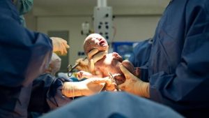 Having a caesarean? Here's what you should know.